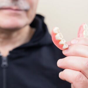 Replacement of missing teeth