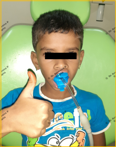 Kid friendly dental clinic-Child showing thumbs up sign while getting dental treatment at our clinic.