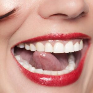 Periodontal health